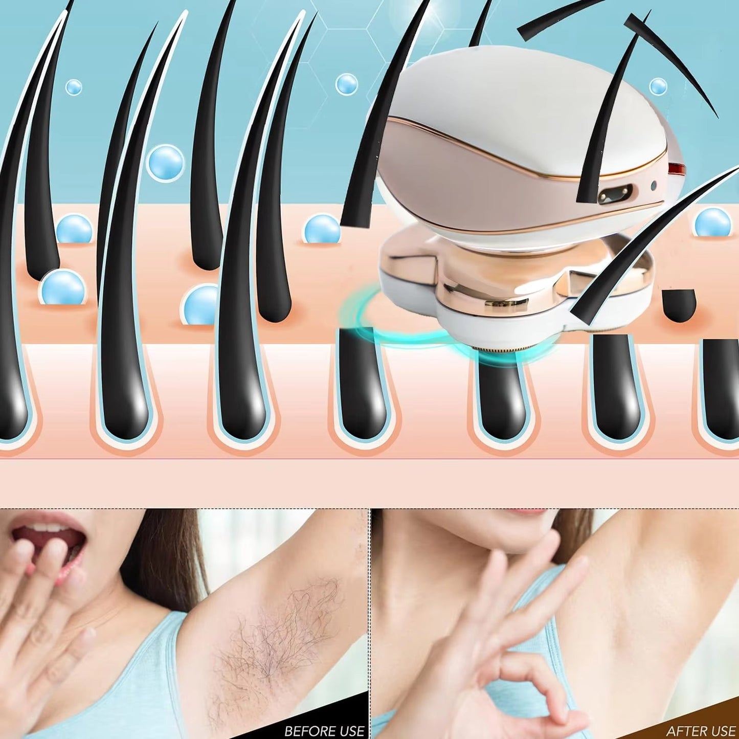 SilkTouch Hair Remover